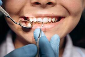 Imagen de Pulpotomía