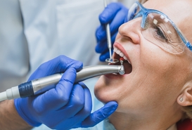 Imagen de Limpieza Avanzada