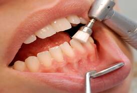 Imagen de Periodoncia